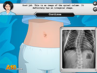 Гра Операція: сколіоз