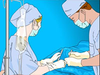 Гра Доктор видаляє апендицит